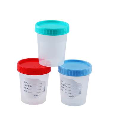 Medical consumables 100ml urine container with screw cap